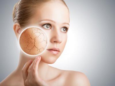 Dry Skin